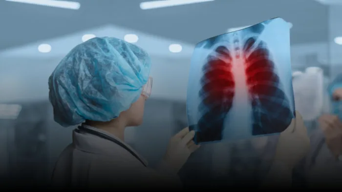 EKG